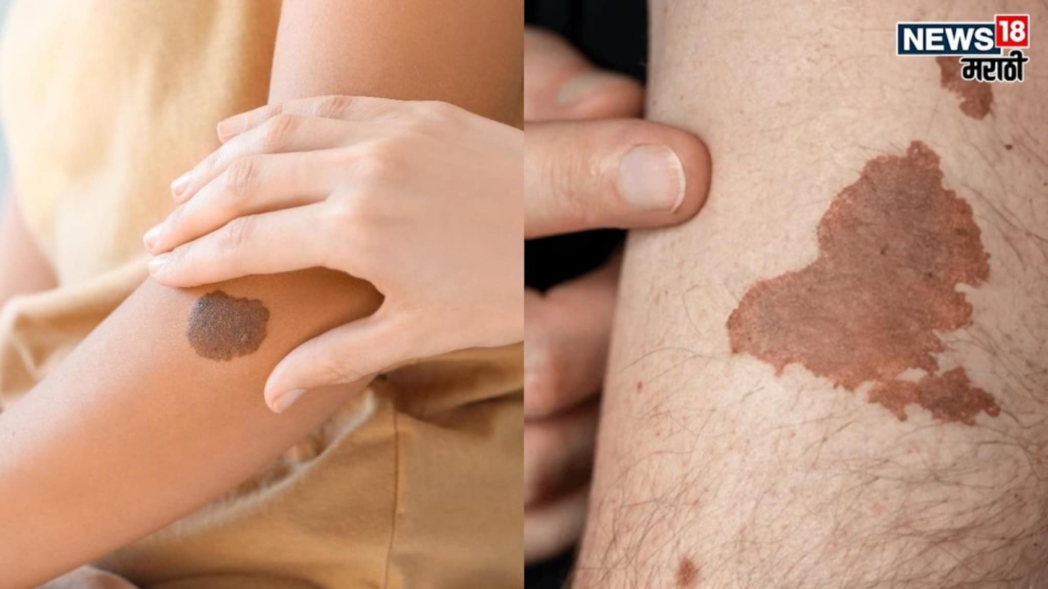 शरीरावरील 'या' खास खुणा उलगडतात भूतकाळातील रहस्य, तुमच्या अंगावर आहेत का 'असे' निशाण?