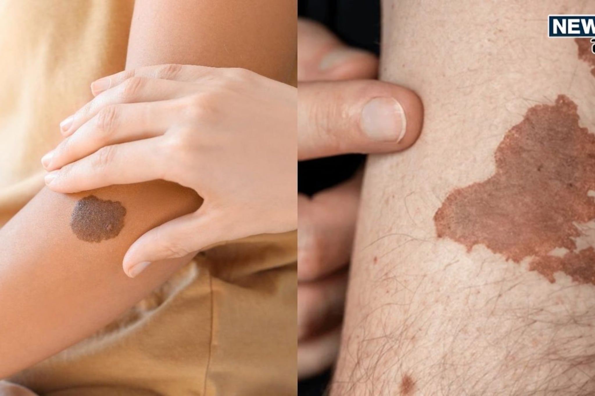 शरीरावरील 'या' खास खुणा उलगडतात भूतकाळातील रहस्य, अंगावर आहेत का निशाण?