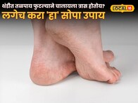 Health Tips: थंडीत तळपाय फुटल्याने चालायला त्रास होतोय? लगेच करा 'हा' सोपा उपाय; पायांना मिळेल आराम!