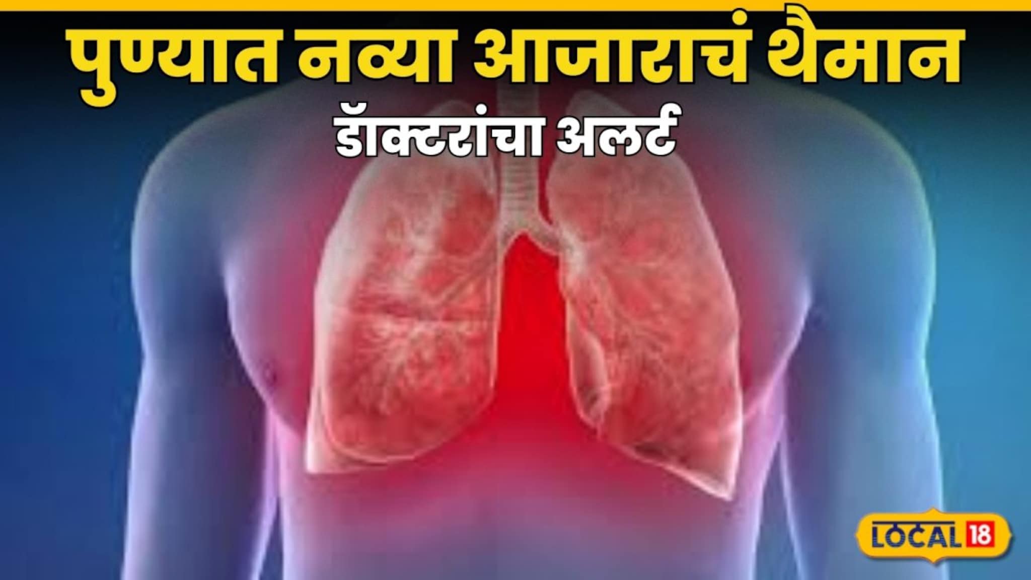7 ते 8 दिवस खोकला राहतो, ताप येतो, पुण्यात नव्या आजाराचं थैमान, डॅाक्टरांचा अलर्ट