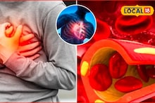 Winter Health Tips: सावधान! थंडीच्या दिवसांत ‘हार्ट अटॅक’चा धोका, कारण काय? अशी घ्या काळजी