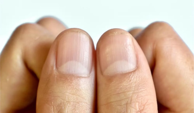 अंगठ्यावरील अर्धचंद्र: अंगठ्याच्या नखावर स्पष्ट आणि पूर्ण अर्धचंद्राकृती निशाण दिसणे अत्यंत शुभ मानले जाते. हे निशाण मजबूत इच्छाशक्ती आणि आत्मविश्वास दर्शवते. यामुळे तुम्हाला करिअरमध्ये मोठी प्रगती आणि यश मिळते.