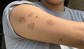 शरीरावरील 'या' खास खुणा उलगडतात भूतकाळातील रहस्य, अंगावर आहेत का निशाण?