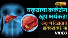 यकृताचा कर्करोग खूप भयंकर! लक्षणं दिसताच डॉक्टरांकडे जा, पोट फुगल्यासारखं वाटलं तर...