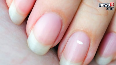 Samudrik Shastra: Nail Marks Predict Future Wealth, Honor & Success