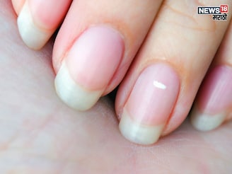 मान-सन्मान, पैशाची कधीच होणार नाही कमी, जर नखांवर दिसत असतील 'असे' डाग