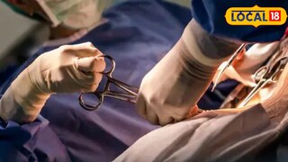 तुटलेला अंगठा परत जोडला (प्रतिकात्मक फोटो) 