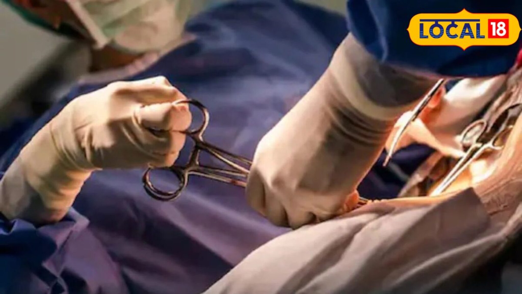 दुचाकीची चेन साफ करताना अंगठा तुटला; जोडण्यासाठी डॉक्टरांचे 5 तास प्रयत्न, अन्..