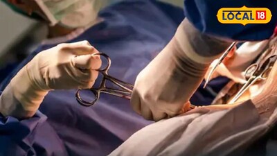 रूबी हॉल किडनी रॅकेट (प्रतिकात्मक फोटो) 