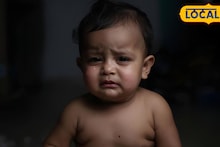 2 वर्षाच्या बाळानं प्यायलं अॅसिड; तोंड, अन्ननलिका जळाली, शेवटी पुण्यातील डॉक्टरांनी केला 'चमत्कार'