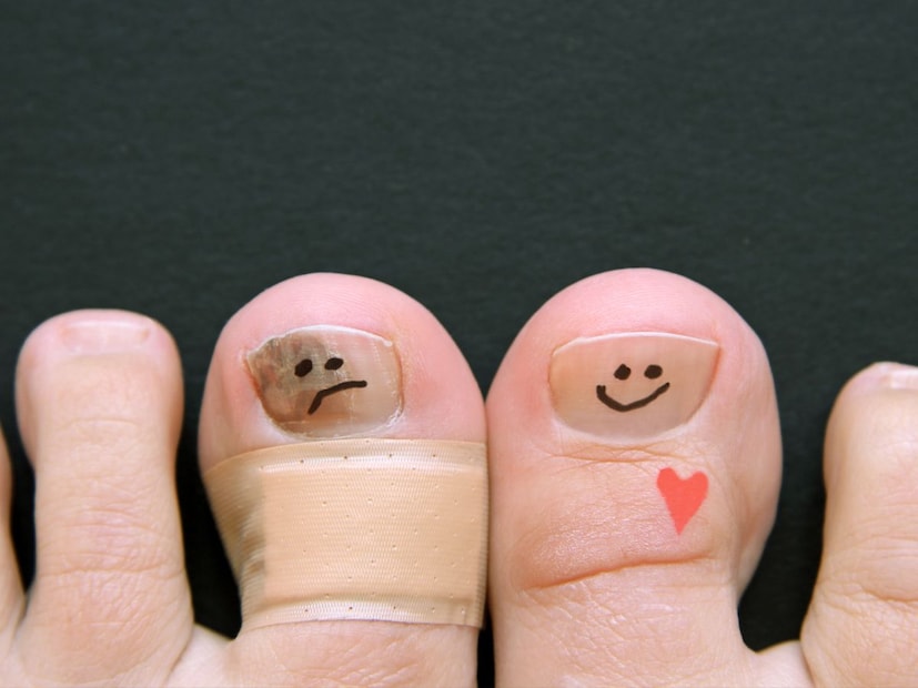 खरंतर बहुतांश लोकांना हातावर किंवा पायावर केस असलेले आवडत नाहीत. सहसा मुलींना असे केस अंगावर आवडत नाहीत त्यामुळे ते वॅक्स करुन किंवा शेव करुन काढतात. पण हे पायाच्या अंगठ्यावरील केस खूप काही सांगतात. चला त्याबद्दल जाणून घेऊ.