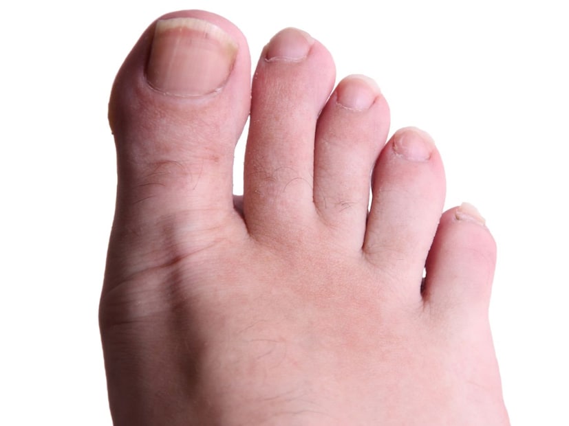 केसांच्या मुळांना (Hair Follicles) जिवंत राहण्यासाठी आणि वाढण्यासाठी स्थिर तसेच मजबूत रक्तप्रवाहाची आवश्यकता असते. जेव्हा शरीरातील रक्ताभिसरण व्यवस्थित असते, तेव्हा केसांची वाढ चांगली आणि मजबूत राहते. पायांवर केस असण्याचा अर्थ तुमच्या शरीरात पायापर्यंत रक्तपुरवठा चांगल्यापद्धतीने होत आहे.