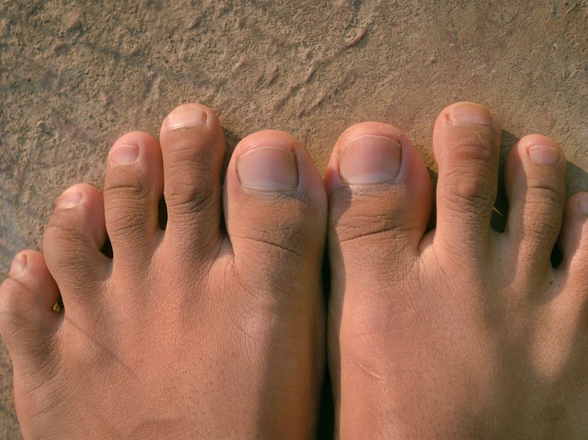 पाय नेहमी थंड राहणे (Cold Feet)पायांना बधिरता किंवा मुंग्या येणे (Numbness or Tingling)
जखमा लवकर बऱ्या न होणे (Slow-healing cuts)
चालताना पायात किंवा पोटरीत गोळा येणं (Leg cramps on walking)