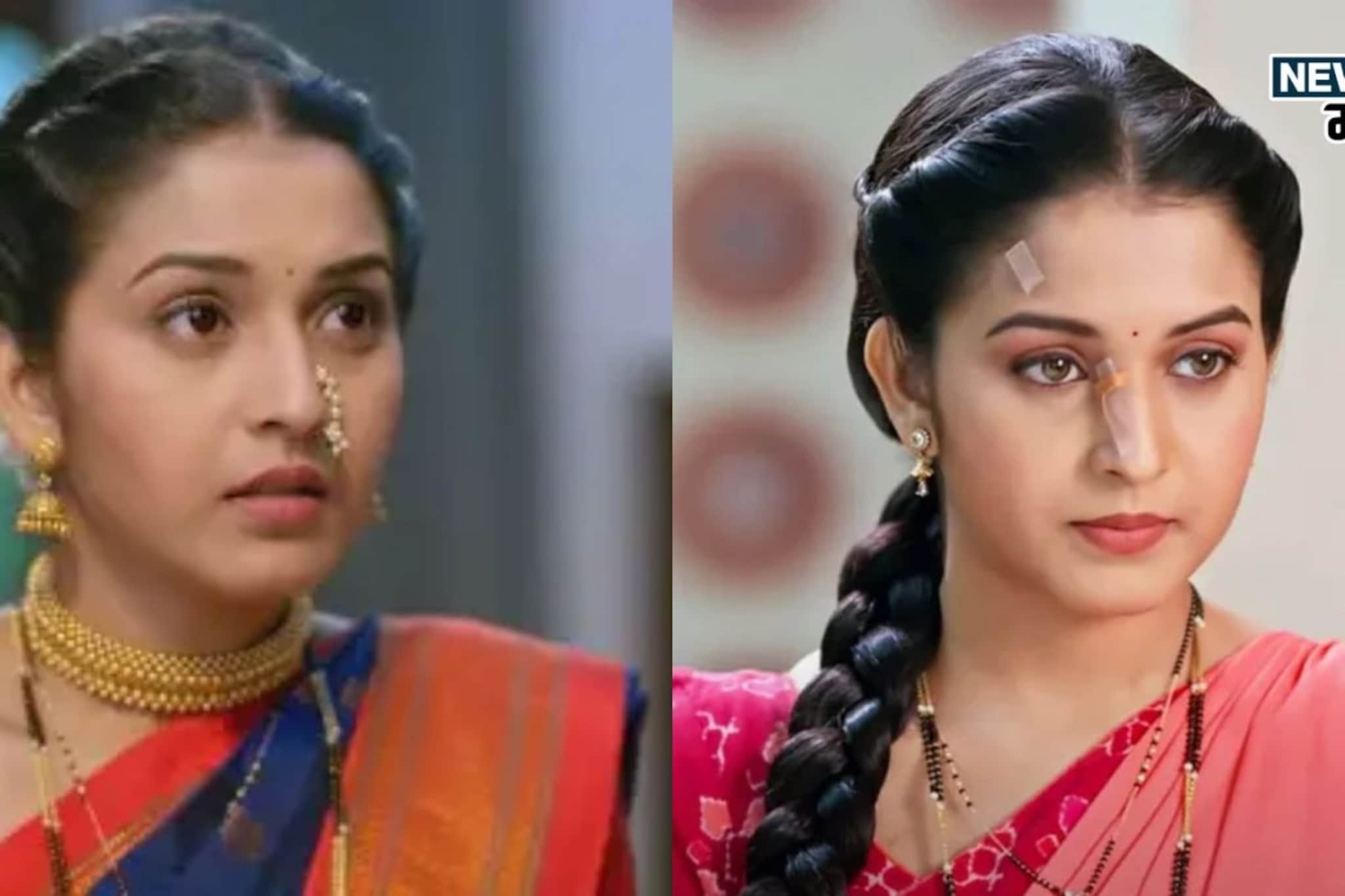 नाकाला पट्टी, डोळ्यांचा रंगही बदलला; 'तुला जपणार आहे' फेम मीराला झालंय काय?