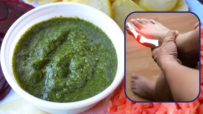 युरिक अ‍ॅसिडसाठी घरगुती उपाय