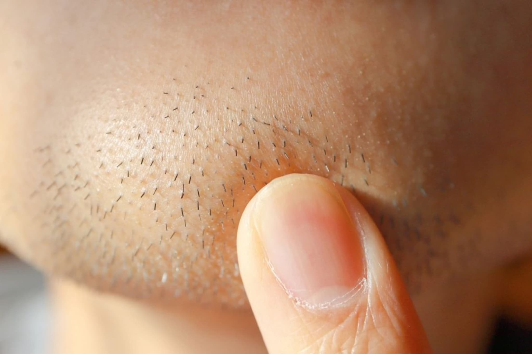 Shocking! वयाच्या 24व्या वर्षी आली दाढी आणि तरुणाचा झाला मृत्यू, नेमकं घडलं काय?