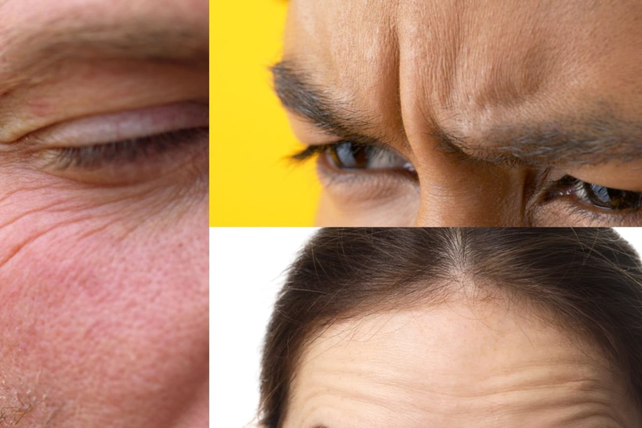 Wrinkles : सुरकुत्या, बारीक रेषांचेही असतात आकार, ऊकार, पाहूयात वेगवेगळे प्रकार