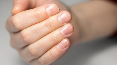 Nail Care: Easy Home Remedies for Strong, Healthy Nails