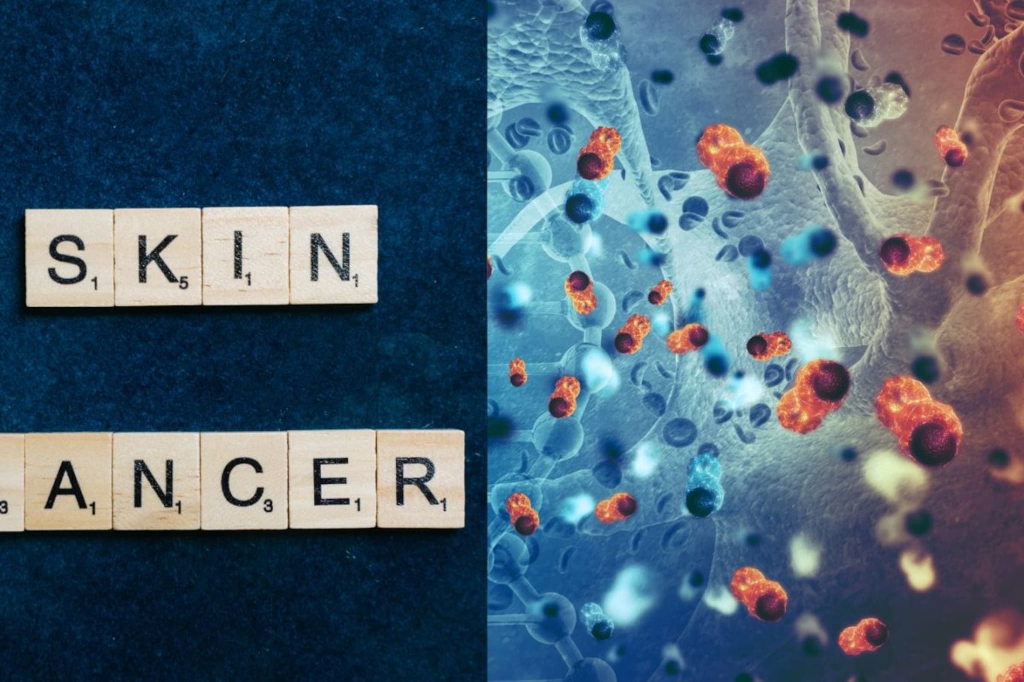 Skin Cancer : मेलेनोमा म्हणजे काय ? मेलेनोमाची लक्षणं कशी ओळखायची ? Skin Cancer : मेलेनोमा म्हणजे काय ? मेलेनोमाची लक्षणं कशी ओळखायची ?