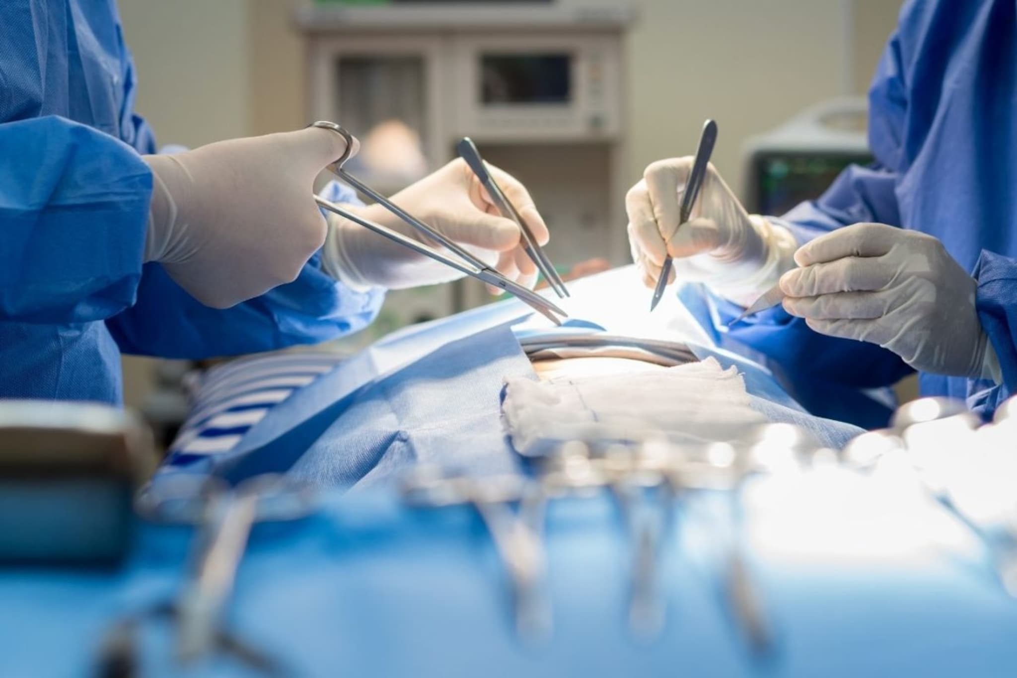 महिला गर्भाशयाची गाठ काढायला गेली; पण भूल देऊन केलं कांड, पुण्यातील 4 डॉक्टरांचा कोर्टाचा दणका