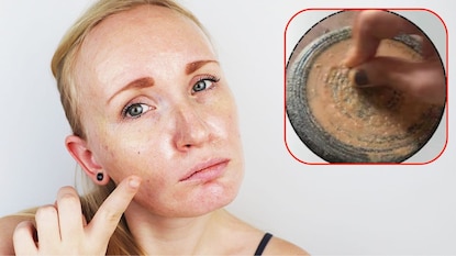 पिग्मेंटेशनसाठी घरगुती उपाय पिग्मेंटेशनसाठी घरगुती उपाय