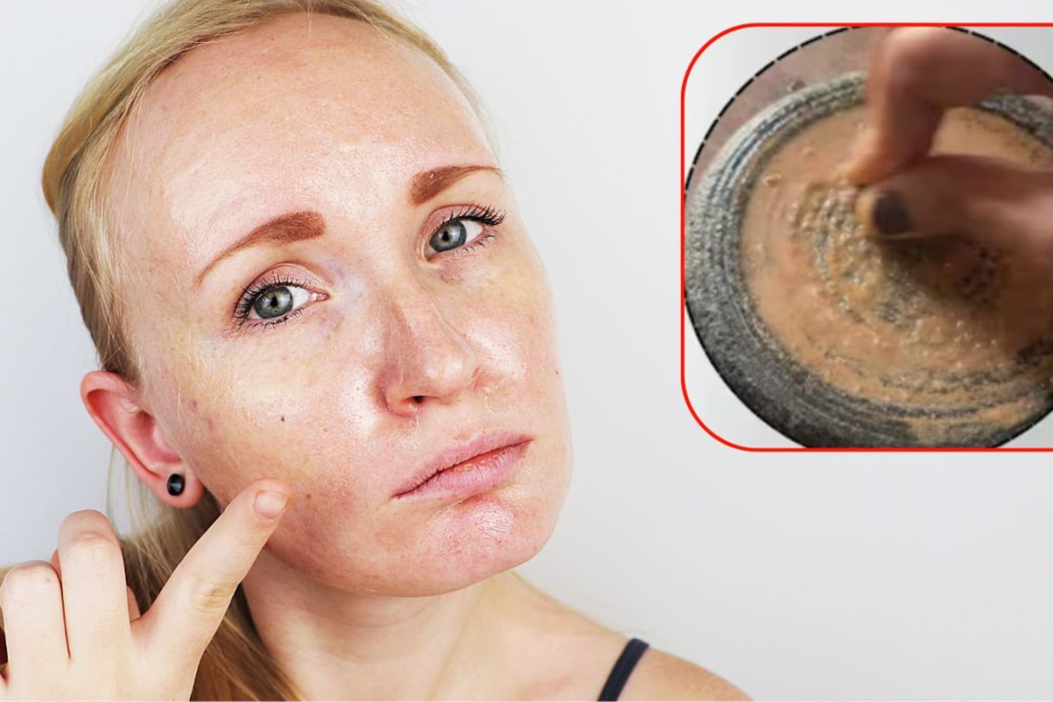 चेहऱ्यावरील पिगमेंटेशन एका महिन्यात होईल गायब! घरी बनवा जायफळाचे मॅजिकल क्रीम