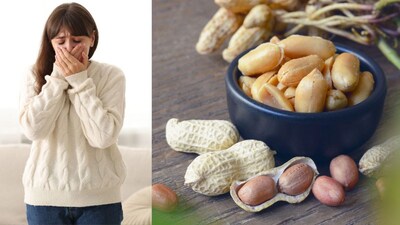 Disclaimer : या बातमीत दिलेली माहिती आणि आरोग्याशी संबंधित सल्ला तज्ञांशी झालेल्या संभाषणांवर आधारित आहे. ही सामान्य माहिती आहे, वैयक्तिक सल्ला नाही. म्हणून, डॉक्टरांचा सल्ला घेतल्यानंतरच काहीही वापरा. त्याच्या वापरामुळे होणाऱ्या कोणत्याही नुकसानासाठी लोकल-18 जबाबदार राहणार नाही. 