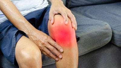 गुडघ्यांमध्ये कटकट असा आवाज ऐकू आला तर काय करावे?
