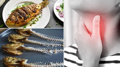 घशात अडकलेले माशाचे हाड काढण्याचे सोपे मार्ग