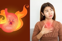 Acid Reflux : अ‍ॅसिड रिफ्लक्सचा त्रास होतोय ? अ‍ॅसिड रिफ्लक्स कशामुळे होतं ? घरगुती उपायांची होईल मदत