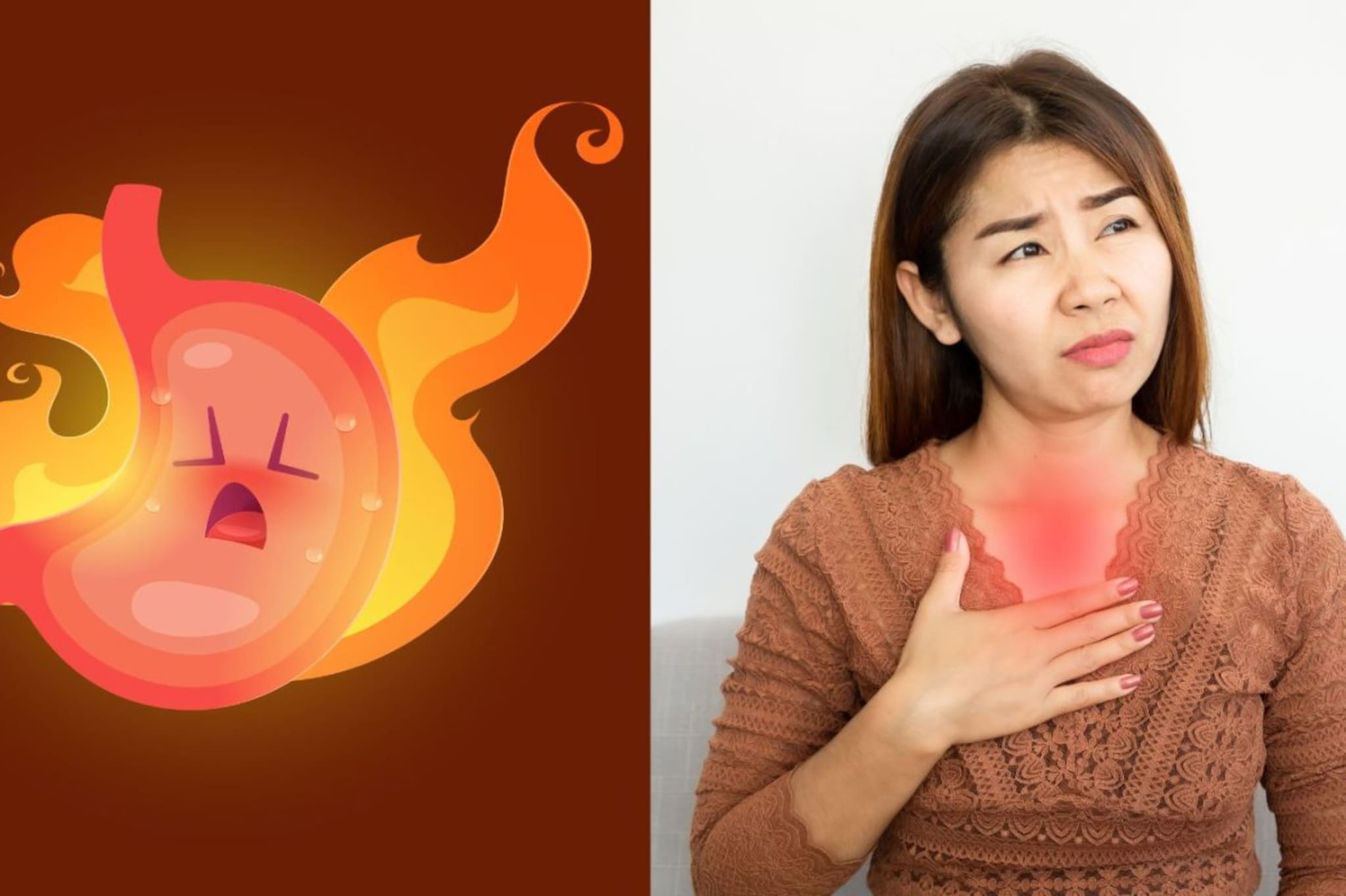 Acid Reflux : अ‍ॅसिड रिफ्लक्स म्हणजे काय ? यावर कोणते उपचार करायचे ?