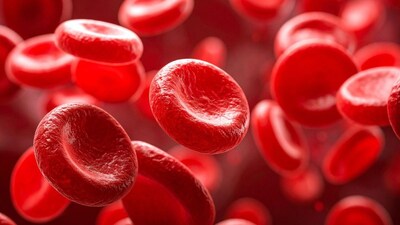 Boost Hemoglobin Naturally: Essential Dietary Changes for Better Health