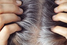 White Hair : सेल्युलर एजिंग म्हणजे काय ? सेल्युलर एजिंगमुळे प्रकृतीवर काय परिणाम होतो ?