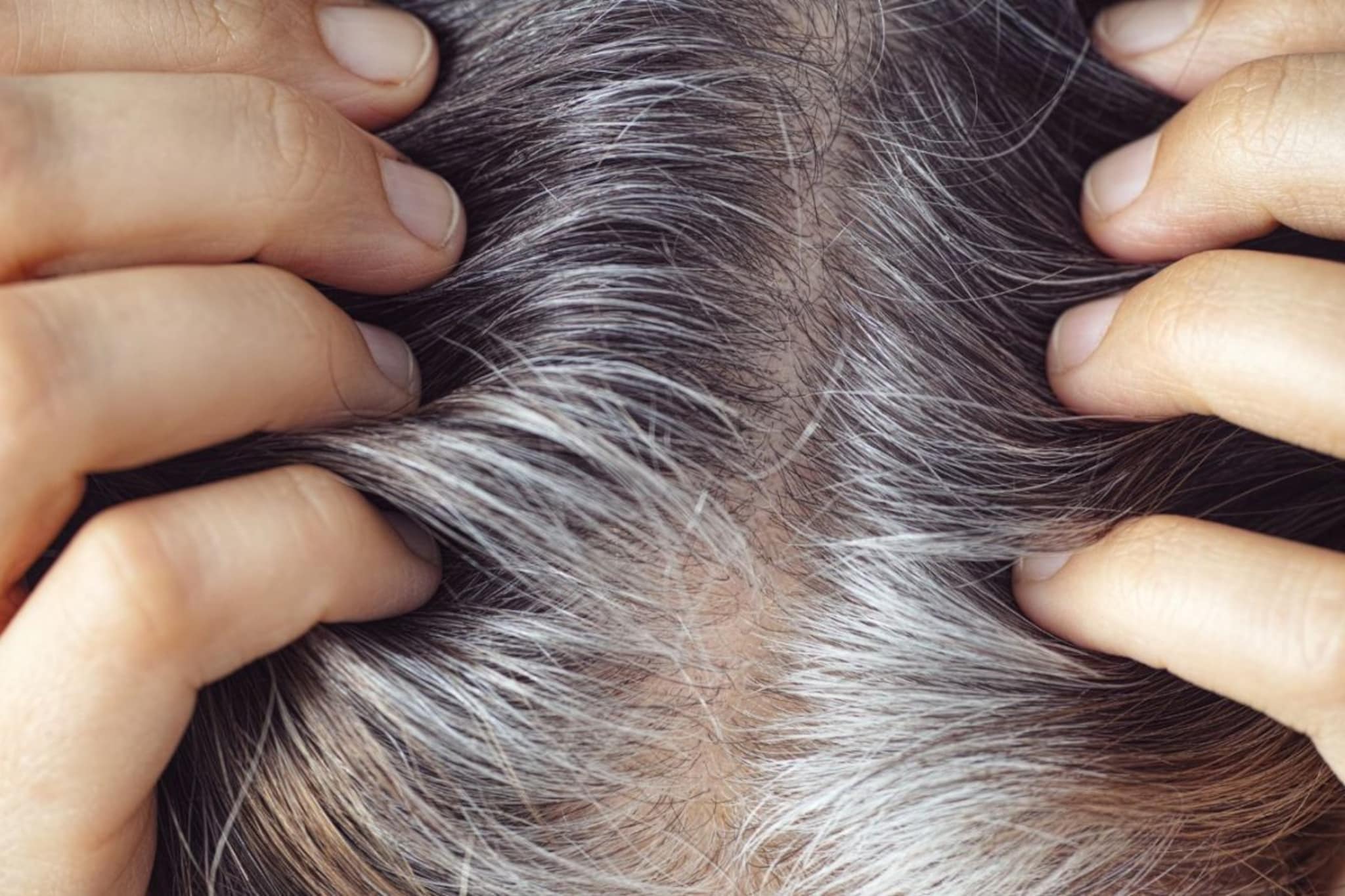 White Hair : तरुण वयातच केस पांढरे का होतात ? पाहूयात केस पांढरे होण्याची कारणं