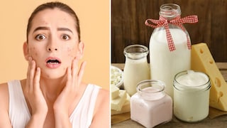 प्रत्येक डेअरी प्रोडक्टमुळे पिंपल्स होतात का? प्रत्येक डेअरी प्रोडक्टमुळे पिंपल्स होतात का?
