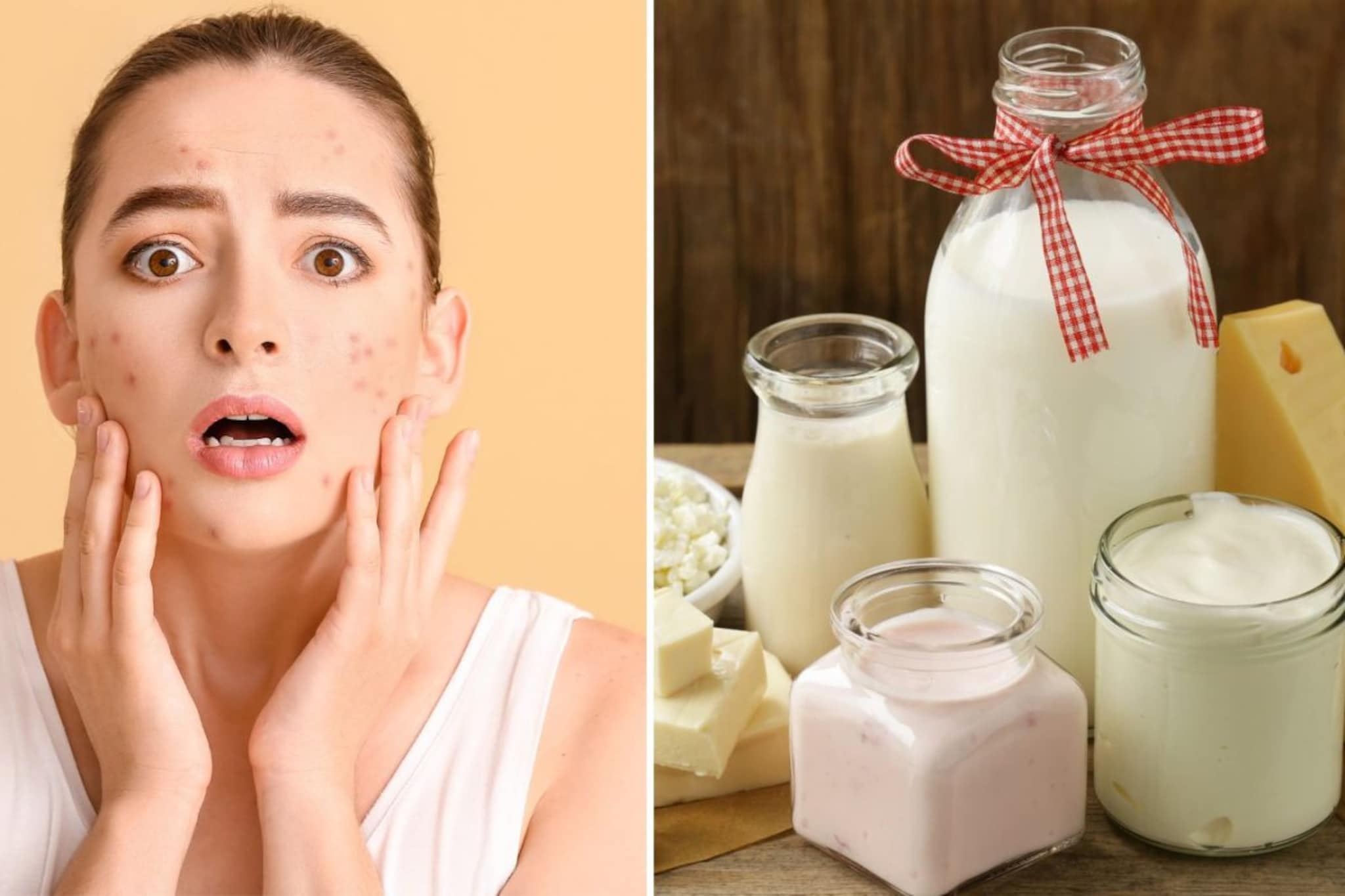 दूध प्यायल्याने चेहऱ्यावरचे पिंपल्स वाढतात का? पिंपल्स होण्याची नेमकी कारणं काय?