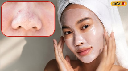 ब्लॅक हेड्स आणि व्हाईट हेड्स टाळण्यासाठी टिप्स ब्लॅक हेड्स आणि व्हाईट हेड्स टाळण्यासाठी टिप्स