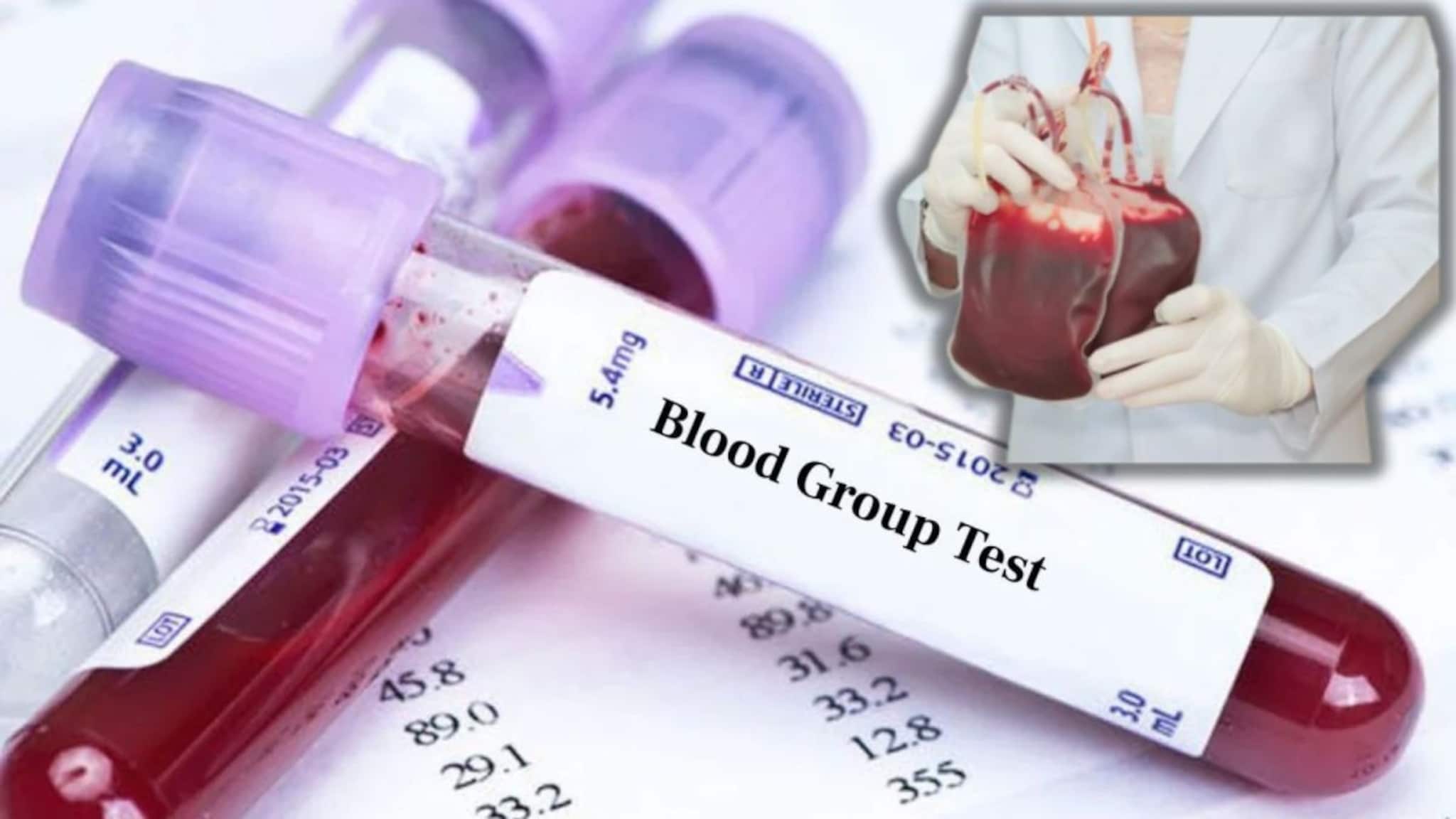 Blood Group: रक्त चढवण्यापूर्वी तुम्ही विचार करत नाही, वाढू शकतो गंभीर आजारांचा धोका; झोप उडवणारे संशोधन, ऐकून तुम्ही चकित व्हाल