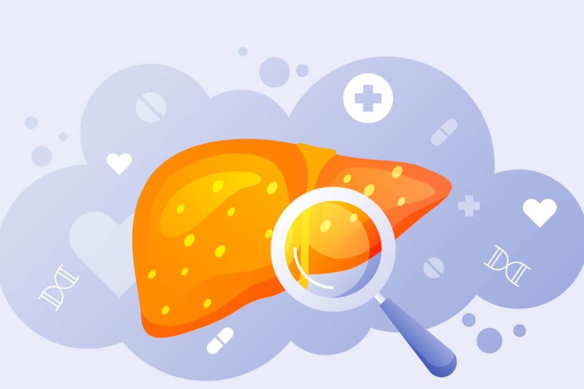 Fatty Liver : फॅटी लिव्हरला silent disease का म्हणतात? शरीरावर काय परिणाम होतात?