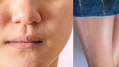 सर्दियों में भी त्वचा रहेगी चमकदार: मुलायम त्वचा के लिए खास टिप्स.