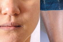 Dry Skin : हिवाळ्यातही त्वचेचा ग्लो राहिल कायम, त्वचा मऊ राहण्यासाठी खास टिप्स