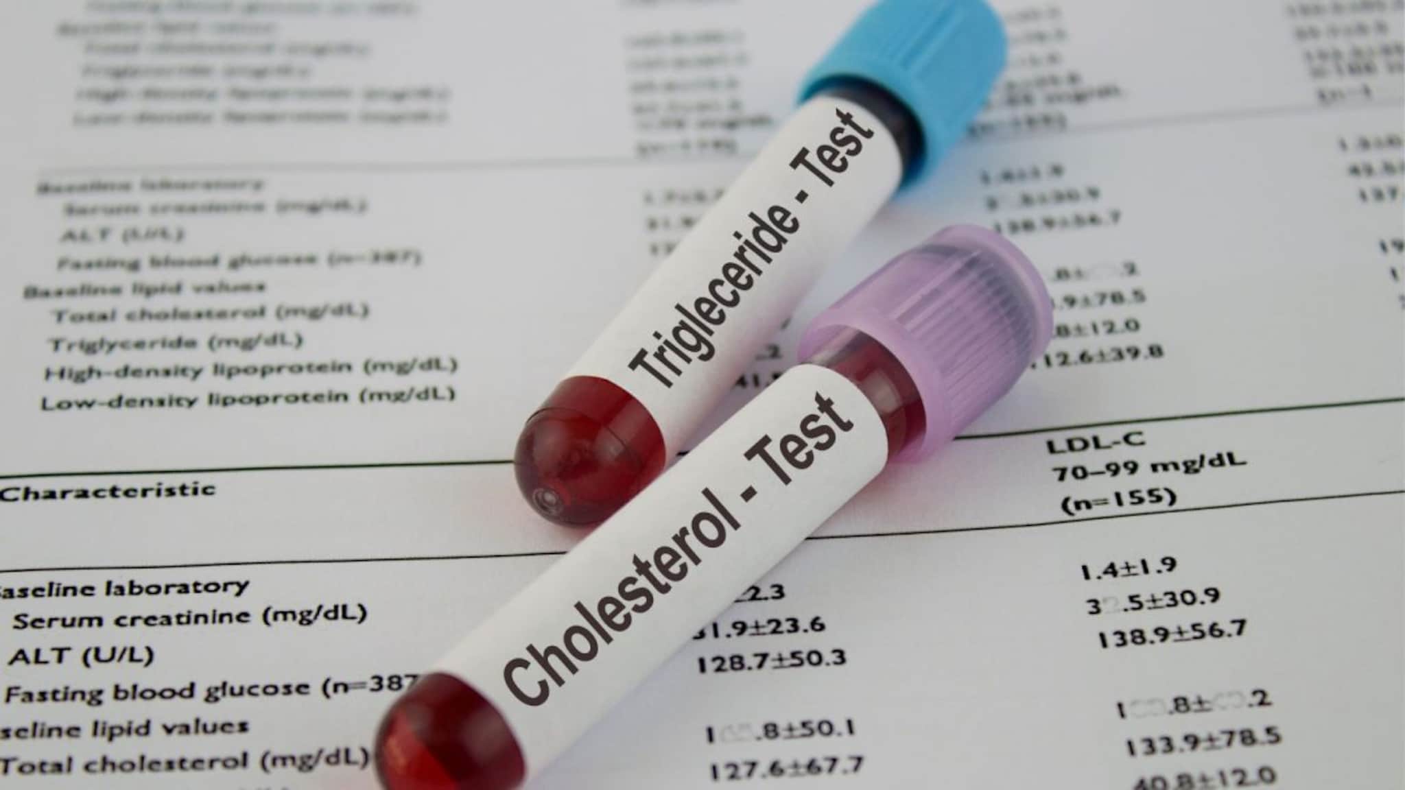 Cholesterol : हाय कोलेस्ट्रॉलची लक्षणं ओळखा, वेळीच उपचारामुळे प्रकृती राहिल चांगली