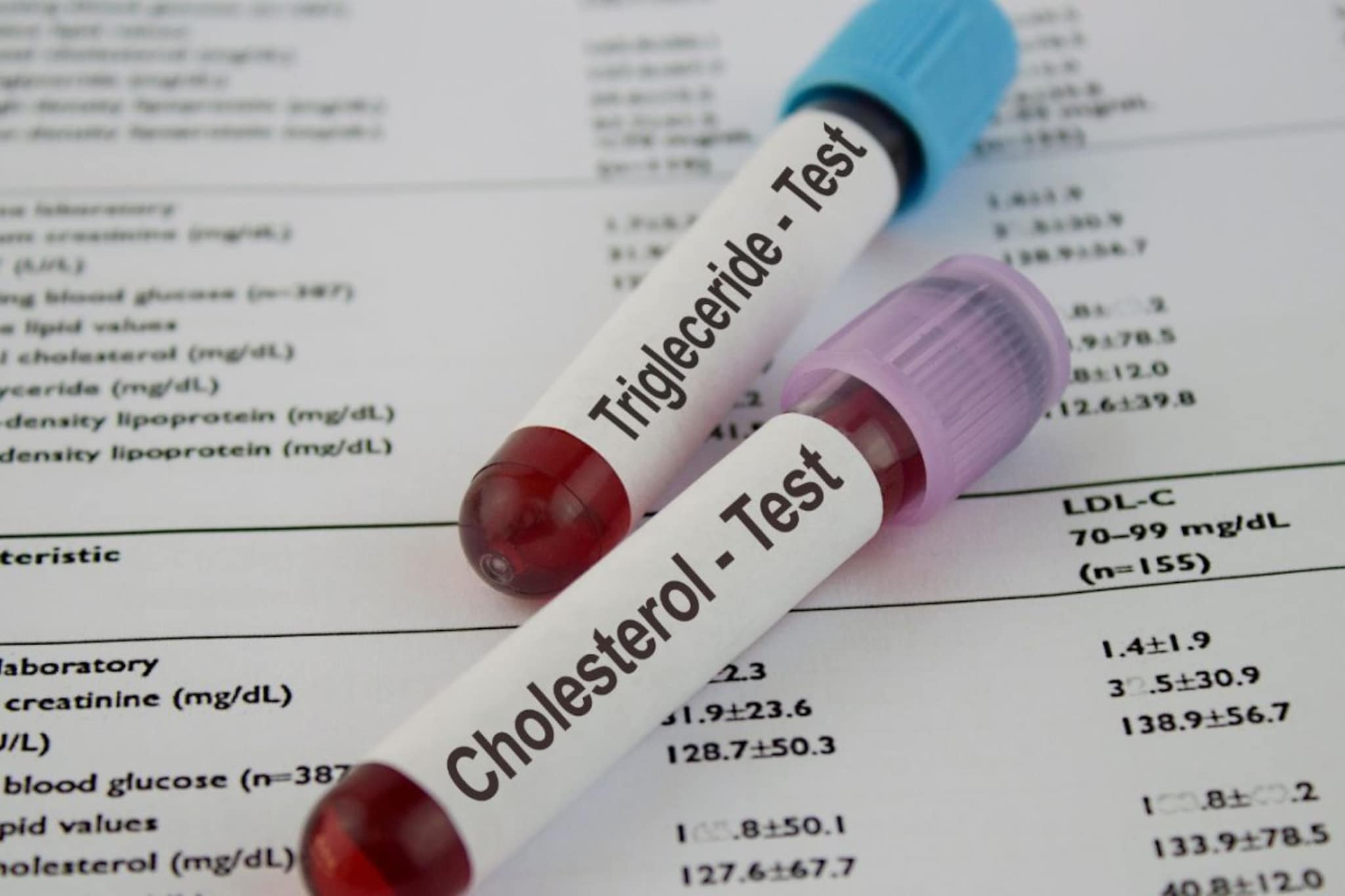 Cholesterol : चेहऱ्यातले बदल सांगतात तब्येतीचे हालहवाल, जाणून घ्या सविस्तर Cholesterol : चेहऱ्यातले बदल सांगतात तब्येतीचे हालहवाल, जाणून घ्या सविस्तर