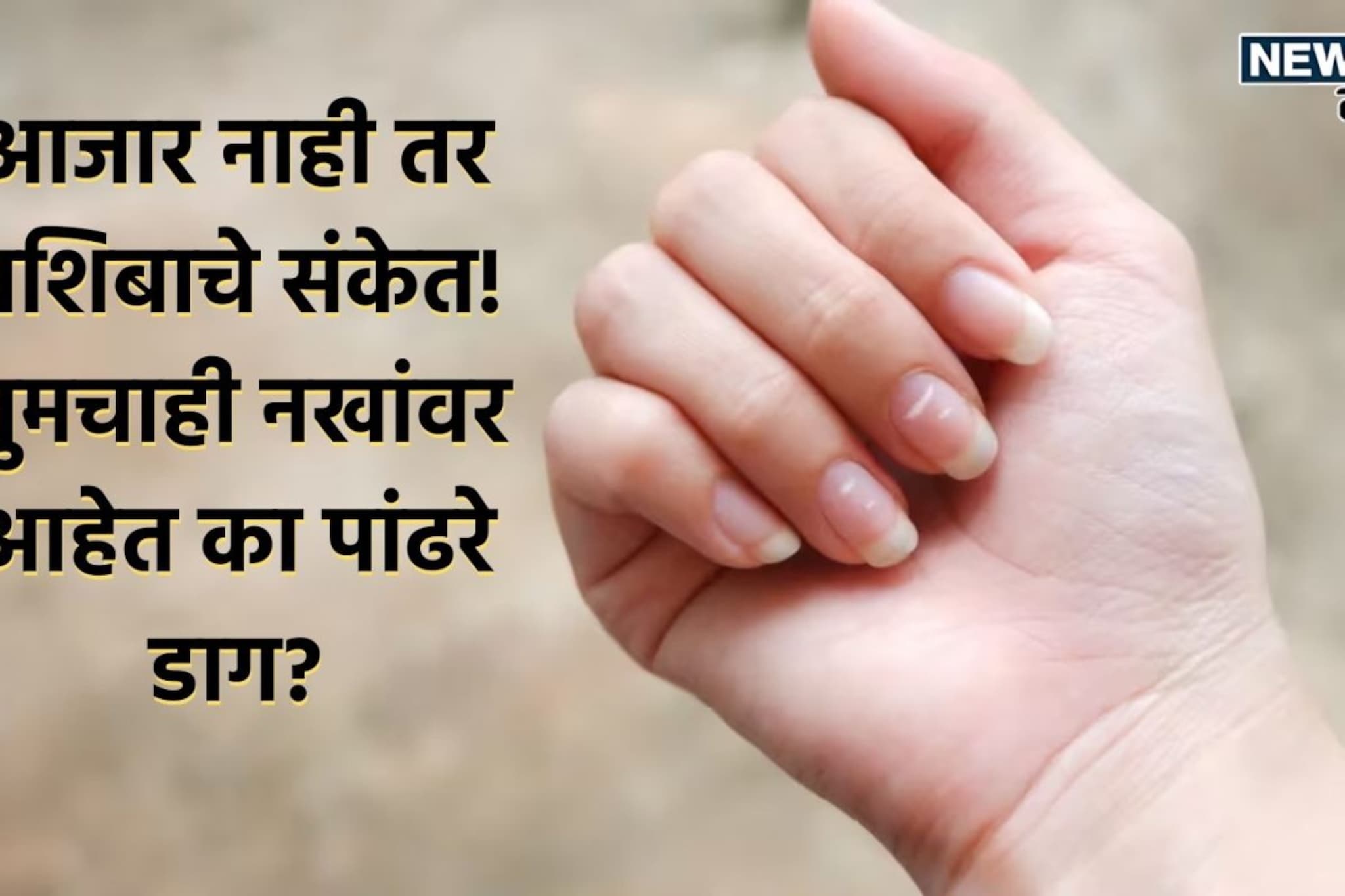 नखांवरील पांढरे डाग देतात 'या' मोठ्या बदलांचे इशारे; तुमच्याही नखांवर आहेत का?
