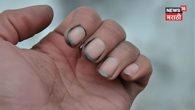 Dirty Nails: The Hidden Cause of Financial Ruin and Poor Health, According to Astrology