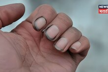 ना पैसा टिकणार, ना आरोग्य सुधारणार, तुमची घाणेरडी नखचं बिघडवणार तुमचं नशीब; वाचा नेमकं कारण!