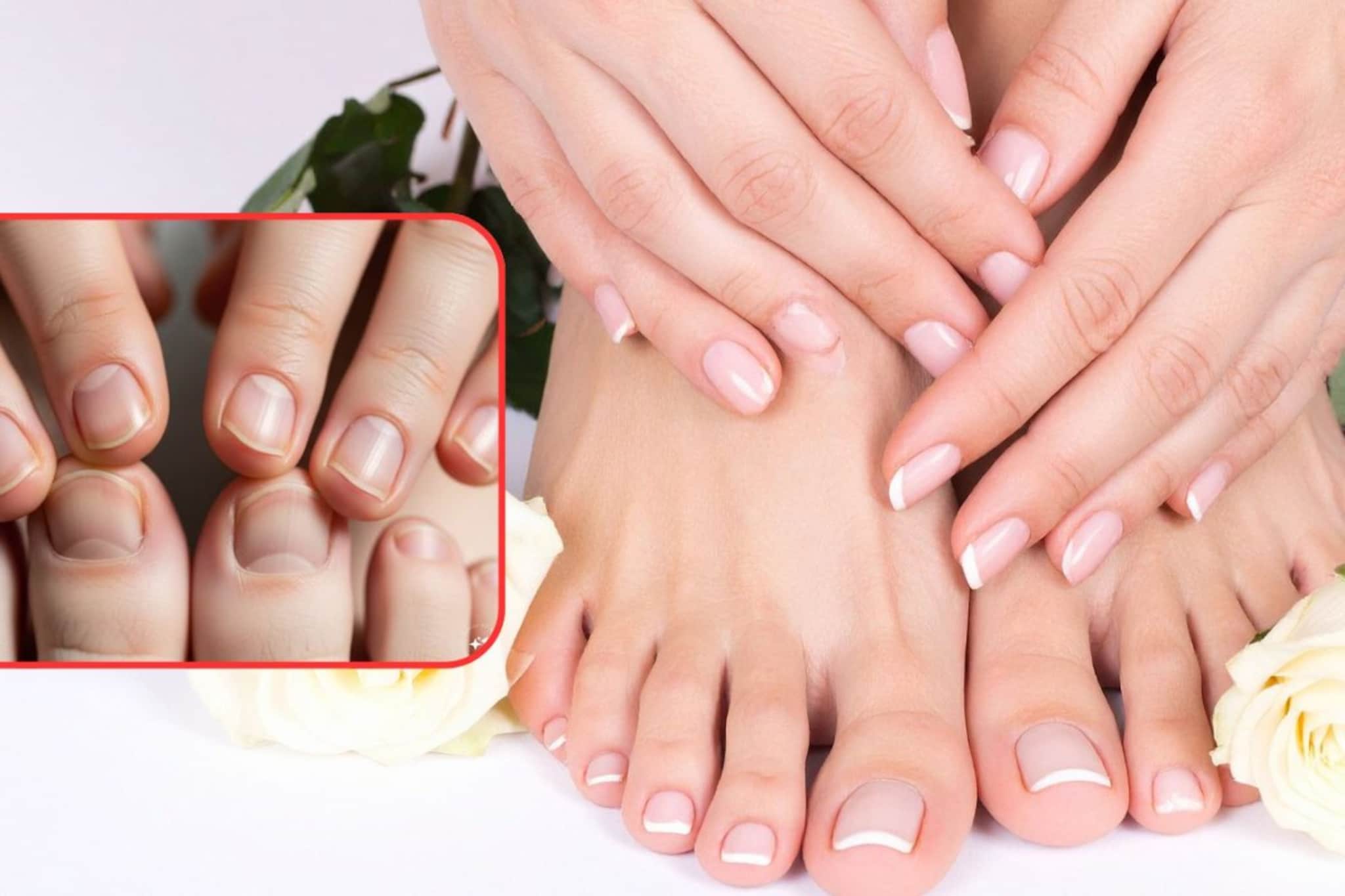 पाय-हातांच्या नखांवरून कळू शकते शरीरात कशाची कमतरता; टाळता येतात मोठ्या समस्या