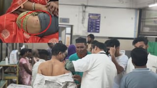 जालन्यात मतदारांवर कुत्र्याचा हल्ला