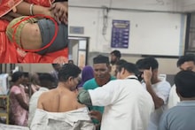 Jalna: मतदानासाठी घराबाहेर पडले, १५ मतदारांवर पिसाळलेल्या कुत्र्याचा हल्ला, लहान मुलाचाही चावा