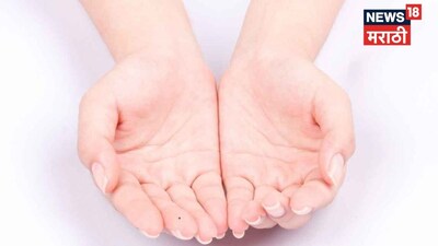 हथेली पर तिल: क्या आप कुबेर जैसी संपत्ति के लिए बने हैं? जानें अपना भाग्य.